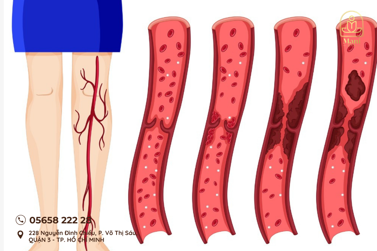 Trị Liệu Lòng Bàn Chân Đông Y TP.HCM | Mani Mani Spa
